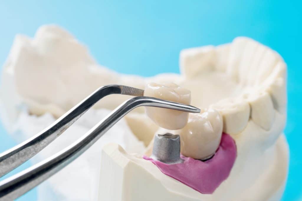 Prosthodontics Knoxville